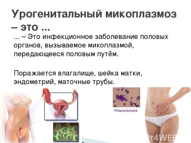 ... – Это инфекционное заболевание половых органов, вызываемое микоплазмой, передающееся половым путём. Поражается влагалище, шейка матки, эндометрий, маточные трубы. Урогенитальный микоплазмоз – это ...