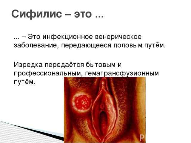 ... – Это инфекционное венерическое заболевание, передающееся половым путём. Изредка передаётся бытовым и профессиональным, гематрансфузионным путём. Сифилис – это ...