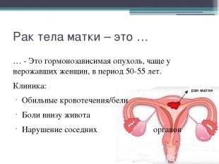 Рак тела матки – это … … - Это гормонозависимая опухоль, чаще у нерожавших женщи