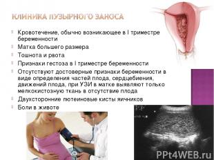 Кровотечение, обычно возникающее в I триместре беременности Матка большего разме