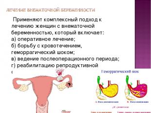 Применяют комплексный подход к лечению женщин с внематочной беременностью, котор