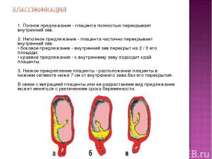 1. Полное предлежание - плацента полностью перекрывает внутренний зев. 2. Неполн