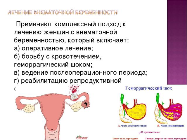 Применяют комплексный подход к лечению женщин с внематочной беременностью, который включает: а) оперативное лечение; б) борьбу с кровотечением, геморрагический шоком; в) ведение послеоперационного периода; г) реабилитацию репродуктивной функции.