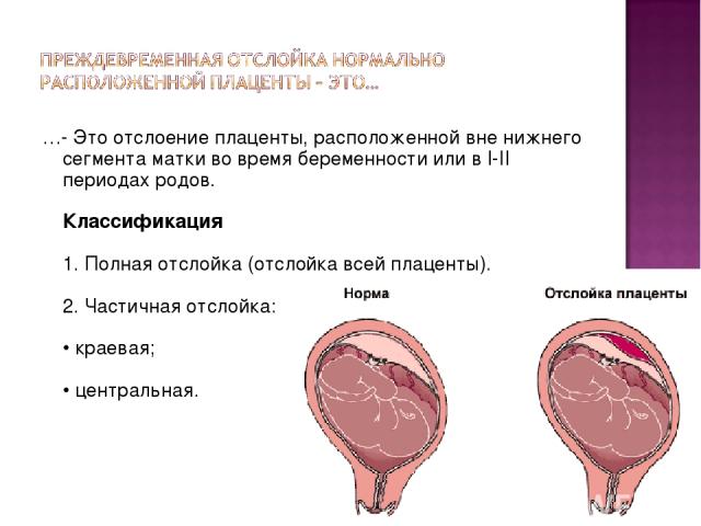 …- Это отслоение плаценты, расположенной вне нижнего сегмента матки во время беременности или в I-II периодах родов. Классификация 1. Полная отслойка (отслойка всей плаценты). 2. Частичная отслойка: • краевая; • центральная.
