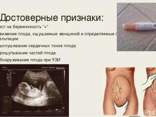 Достоверные признаки: Тест на беременность "+" Движение плода, ощущаемые женщино