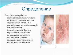 Определение Рожа (англ. еrysipelas) — инфекционная болезнь человека, вызываемая