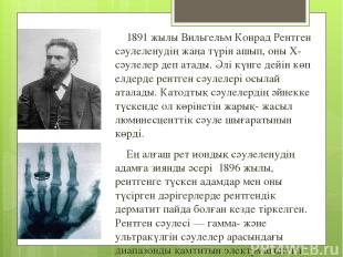 1891 жылы Вильгельм Конрад Рентген сәулеленудің жаңа түрін ашып, оны Х-сәулелер