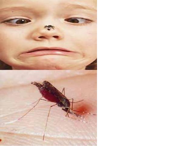 Аллергия на укусы таких насекомых встречается крайне редко, и в этом случае необходимо сразу обратиться к врачу. Для уменьшения боли и зуда от укусов следует принимать те же меры, что и при укусах пчел, шмелей и ос. Также не забывайте, что расчесыва…