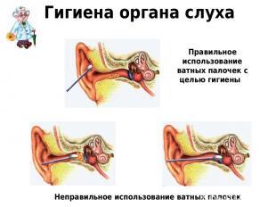 Гигиена органа слуха Правильное использование ватных палочек с целью гигиены Неп